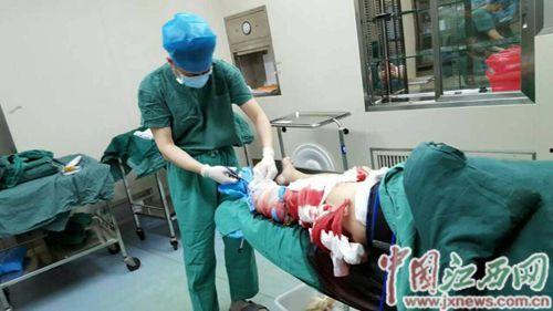 小腿截肢手术视频,技术革新与康复之路